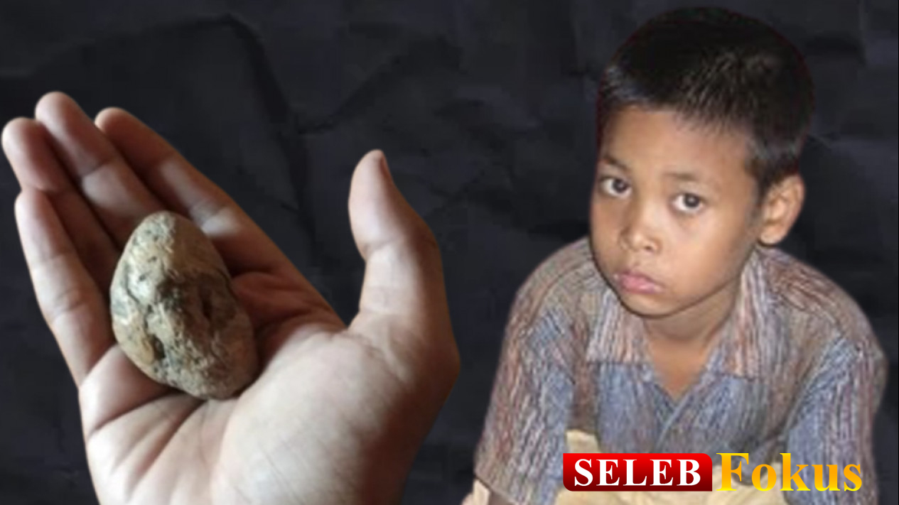 Bocah Ponari Yang Fenomena
